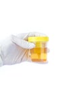 Hand holding a urine sample Royalty Free Stock Photo