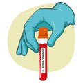 Hand holding a vial with blood for examining corona virus Royalty Free Stock Photo