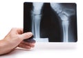Hand holds radiograph Royalty Free Stock Photo