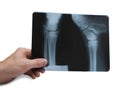 Hand holds radiograph Royalty Free Stock Photo