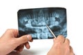 Hand holds radiograph Royalty Free Stock Photo