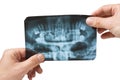 Hand holds radiograph Royalty Free Stock Photo