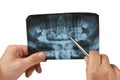 Hand holds radiograph Royalty Free Stock Photo
