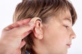 Hand inserting a hearing aid in a young boy`s ear Royalty Free Stock Photo
