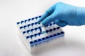 Hand of a laboratory technician holding a tube with a biological sample for cryogenic storage Royalty Free Stock Photo