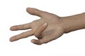 Hand of a male patient with Dupuytren's contracture, photorealistic 3D illustration