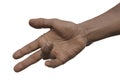 Hand of a male patient with Dupuytren's contracture, photorealistic 3D illustration