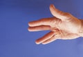 Hand of an man with Dupuytren contracture on blue Royalty Free Stock Photo