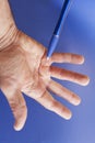 Hand of an man with Dupuytren contracture on blue