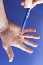 Hand of an man with Dupuytren contracture on blue