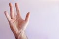 Hand of an man with Dupuytren contracture Royalty Free Stock Photo