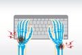 Hand pain from use keyboard