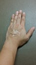 Hand with plaster