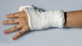 Hand with plaster to immobilize the wrist and the thumb