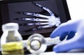 Hand radiography in hospital Royalty Free Stock Photo