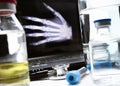 Hand radiography in hospital Royalty Free Stock Photo
