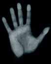 Hand scan