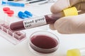 Hand of scientist holds test tube with blood for Bloof group test