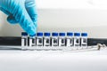 Hand of the scientist pick up the vial of sample solution to analyze by Liquid Chromatography mass spectrometry LC-MS instrument