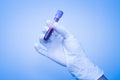 Hand of scientist taking a blood sample tube