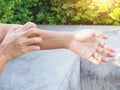 hand scratching on arm from itching with skin diseases, dry skin problems, dermatitis or eczema Royalty Free Stock Photo