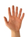 Hand with six fingers