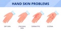 Hand skin problems. Dry skin with cracks, dermatitis and eczema. The consequences of improper care and frequent hand