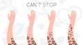 Hand with tattoo. Can`t stop. Tattoo expansion process. Hobby progress. Cute simple cartoon design. Flat style vector illustratio