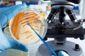 hand of technician holding plate with bacterial colonies of Streptococcus agalactiae and microscope in background