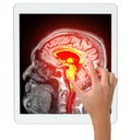 A hand touches a tablet screen displaying a brightly highlighted MRI brain scan, focusing on the central brain structures in red Royalty Free Stock Photo
