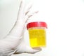Hand with urine container Royalty Free Stock Photo