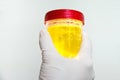 Hand with urine container Royalty Free Stock Photo