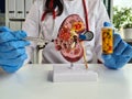 Hand of urologist doctor with pills kidney anatomy in clinic Royalty Free Stock Photo