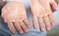 Hand washing medical procedure step. Royalty Free Stock Photo