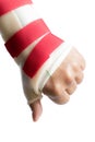 Hand with wrist and thumb splint Royalty Free Stock Photo