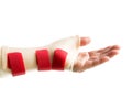 Hand with wrist and thumb splint