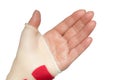 Hand with wrist and thumb splint