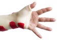 Hand with wrist and thumb splint Royalty Free Stock Photo