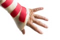 Hand with wrist and thumb splint Royalty Free Stock Photo