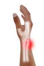 Hand, wrist x-ray Oblique view fracture distal ulna pain and swelling ,Medical image concept on white background