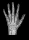 Hand x-ray Royalty Free Stock Photo