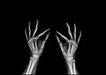 Hand x-ray and test finger to finger Royalty Free Stock Photo