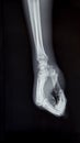 Hand x-ray view Royalty Free Stock Photo