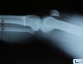 Hand x-ray view Royalty Free Stock Photo