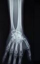 Hand x-ray view Royalty Free Stock Photo