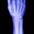 Hand x-ray view Royalty Free Stock Photo