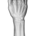 Hand x-ray view Royalty Free Stock Photo