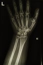 hand x-rays image Royalty Free Stock Photo