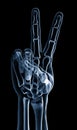 Hand xray Royalty Free Stock Photo