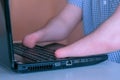 Disabled man with amputated two stump hands is typing on laptop, closeup view. Royalty Free Stock Photo